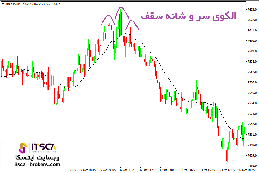 الگوی سر و شانه سقف